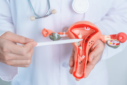 A 4-Step Routine for Managing PCOS